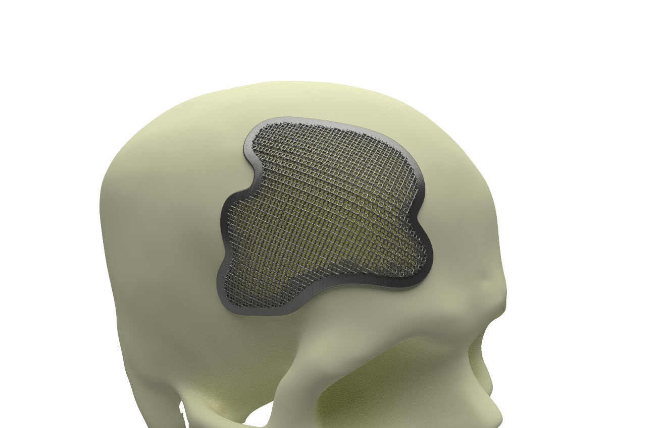skull generative design lattice.jpg
