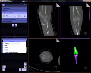 Additive Manufacturing Technology + Medical Industry = Innovation