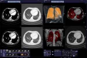 Artificial intelligence development is changing how industry works