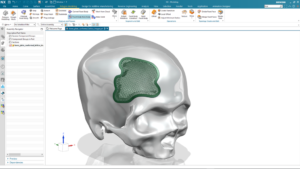 Digital Transformation for Medical Device Design