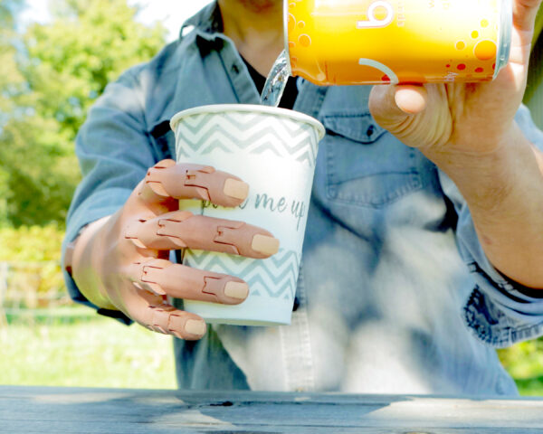 Unlimited Tomorrow is changing the world with 3D printing – One TrueLimb at a time