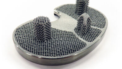 LimaCorporate creates pioneering medical implants with additive manufacturing