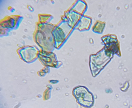Mica particles under a microscope