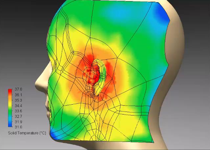 Transient simulation - Skin temperature