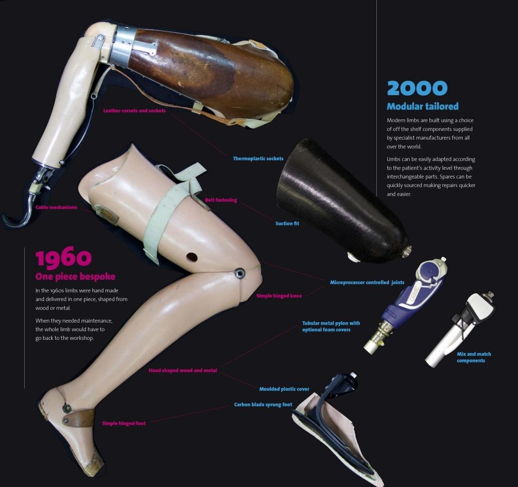 Timeline of the prosthetic leg