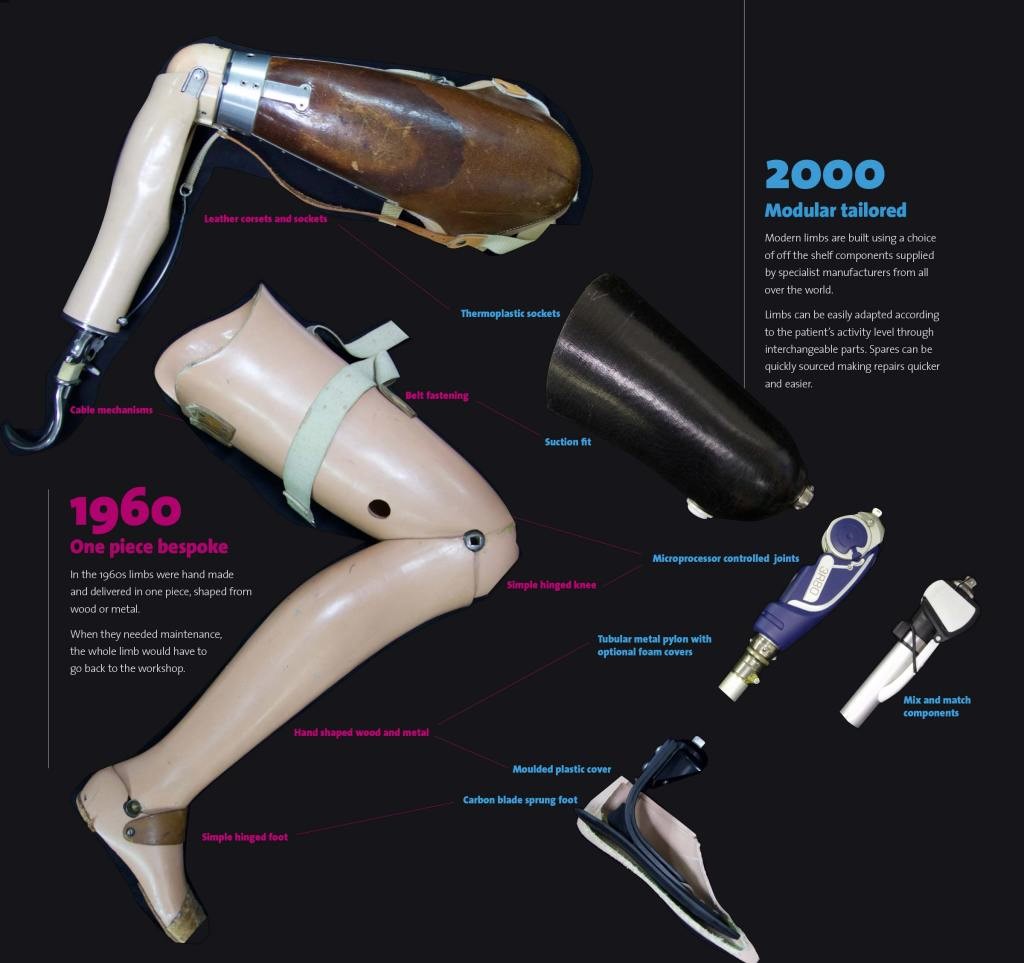 Journey on my Prosthetic Leg - Simcenter