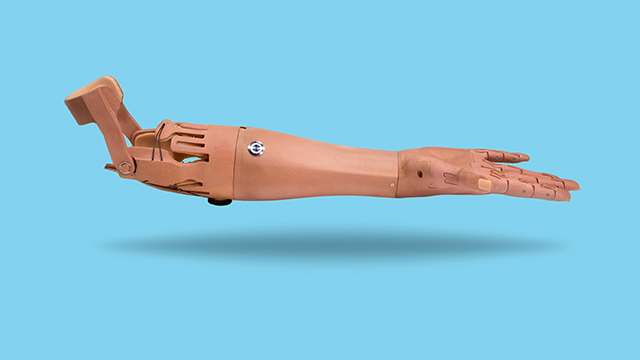 True Limb - prosthetic arm from Unlimited Tomorrow