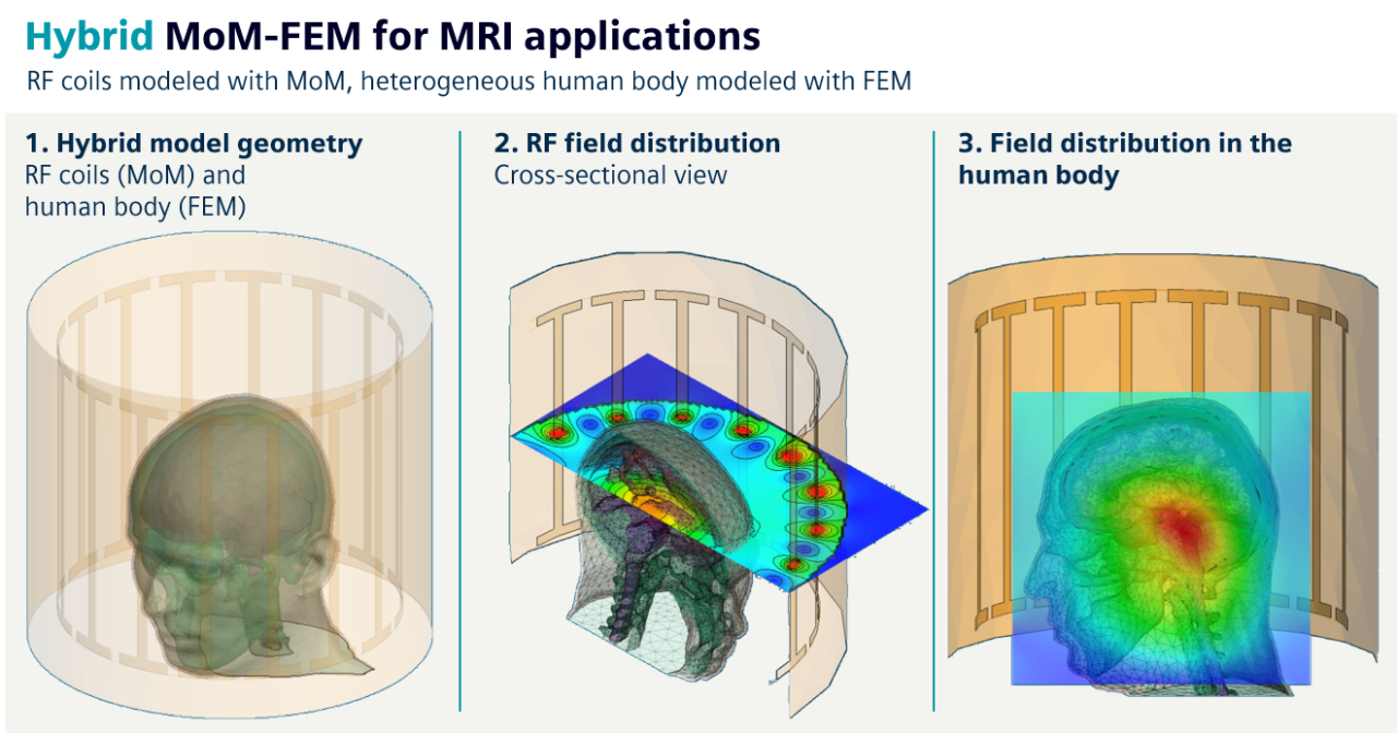 Three views of a hybrid MoM-FEM MRI simulation showing RF coils surrounding a human head model and electromagnetic field distributions in and around the head.